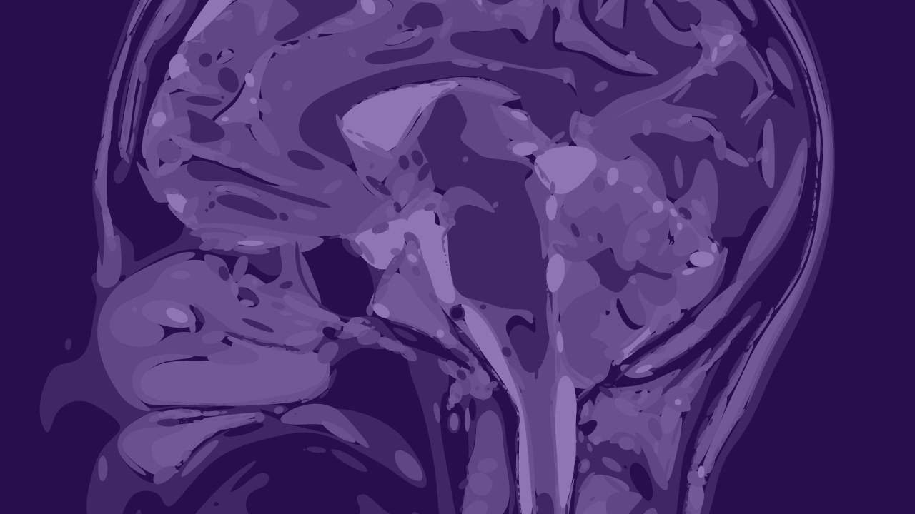 NEURO INTERESTING CASE THUMBNAIL