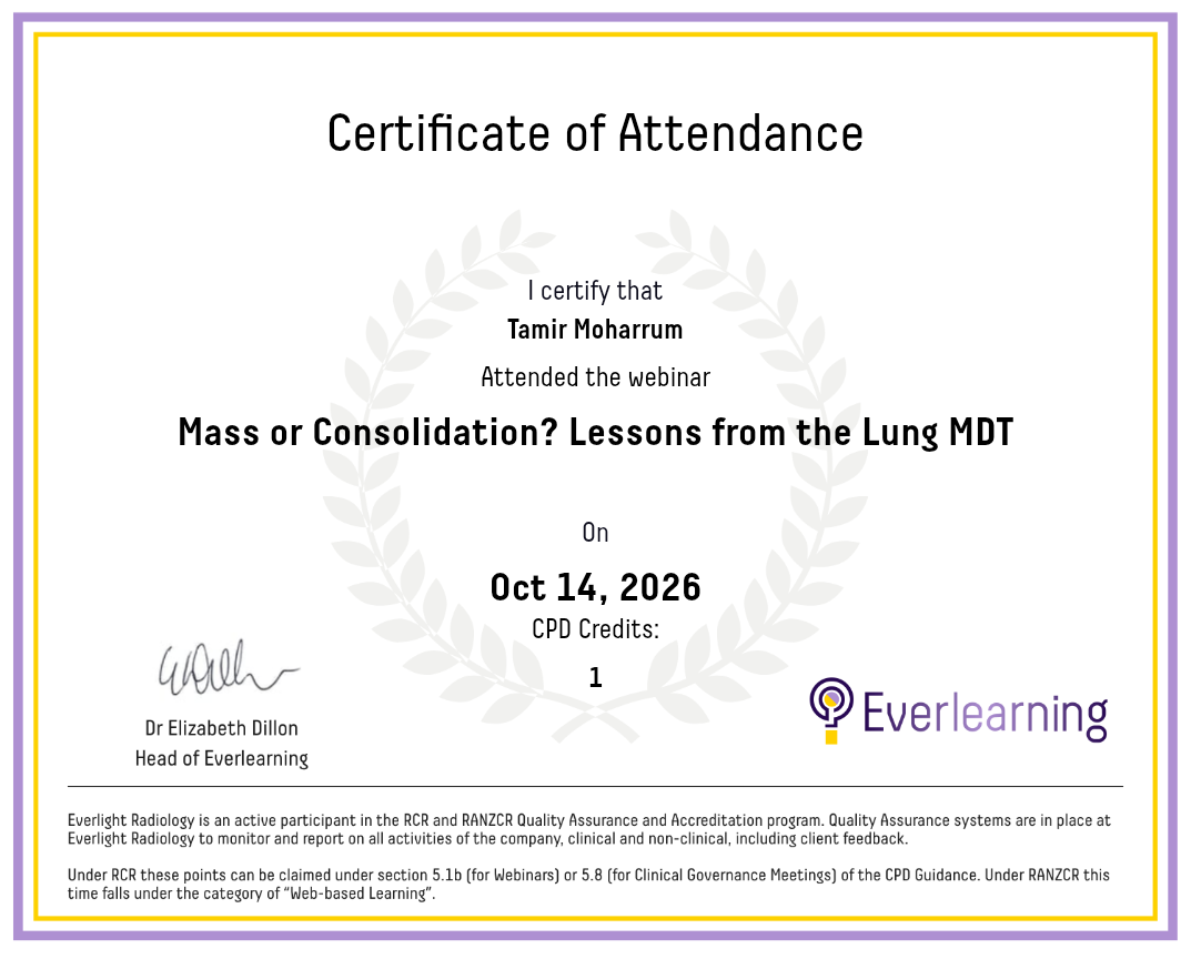 Mass or Consolidation? Lessons from the Lung MDT Certificate