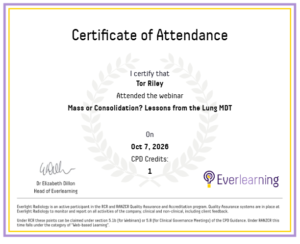Mass or Consolidation? Lessons from the Lung MDT Certificate