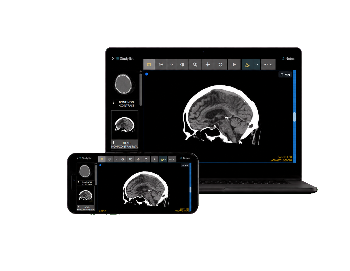 pacs-device-mockup-transparent-v2 pacs-device-mockup-transparent-v2